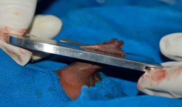 Infant Circumcision Training